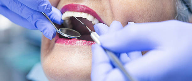 Best Emergency Wisdom Teeth Removal in Grace, ID